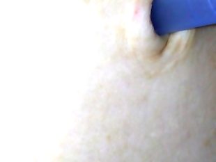 Pen cap in my belly button